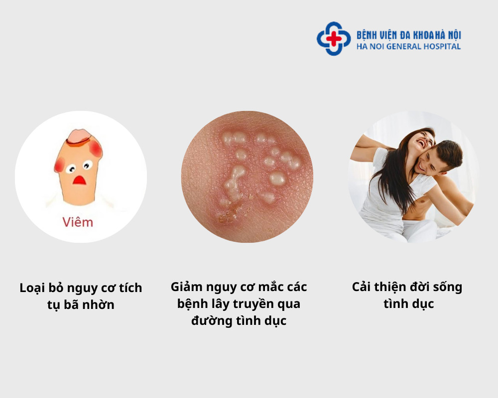 Lợi ích của việc cắt bao quy đầu ở tuổi 30
