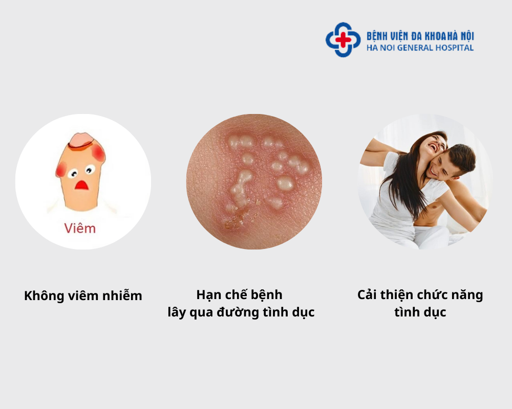 Những lợi ích của cắt bao quy đầu