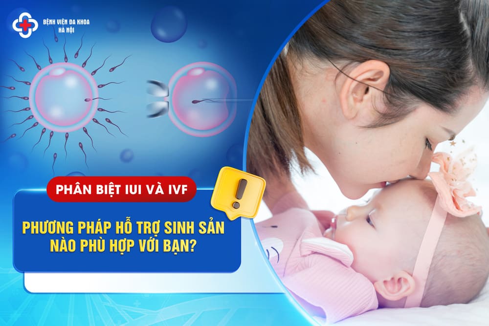 Phân biệt IUI và IVF