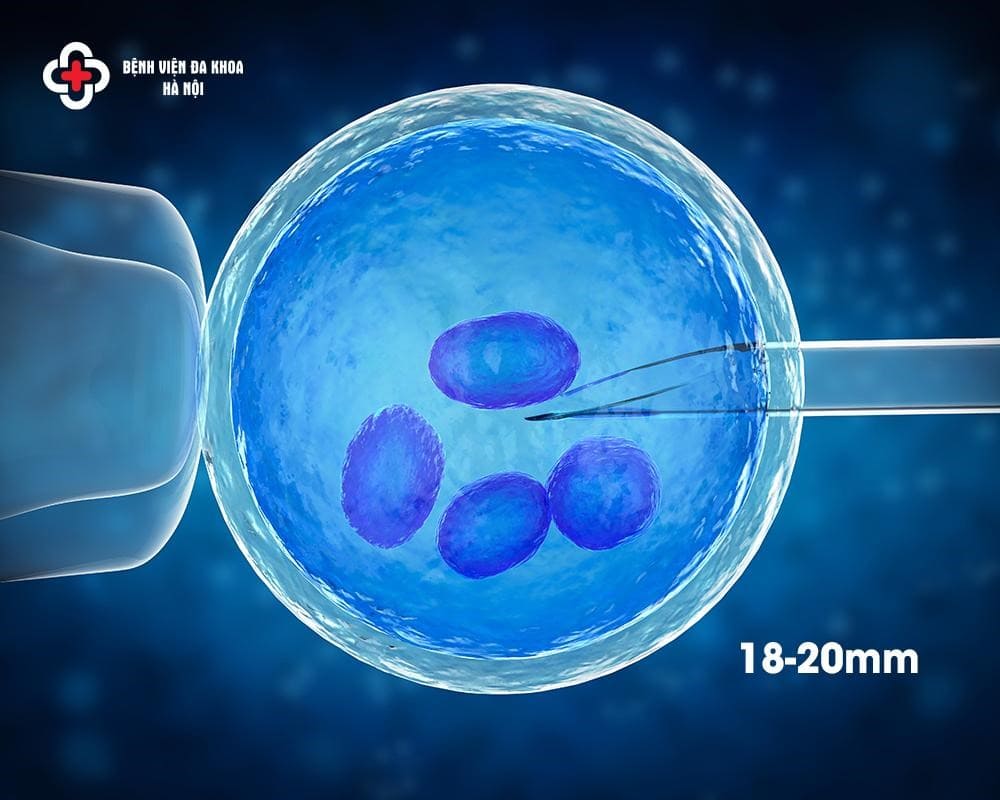 Trứng Đạt Kích Thước Bao Nhiêu Thì Làm IVF