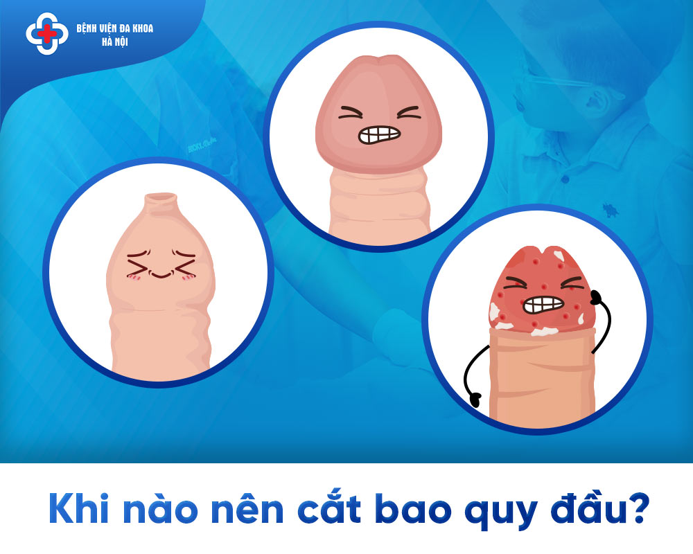 Trường hợp cần cắt bao quy đầu