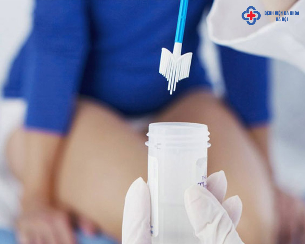 Xét nghiệm Thinprep tầm soát bất thường tế bào cổ tử cung kết hợp sàng lọc virus HPV giúp phát hiện trên 90% nguy cơ ung thư cổ tử cung giai đoạn sớm.