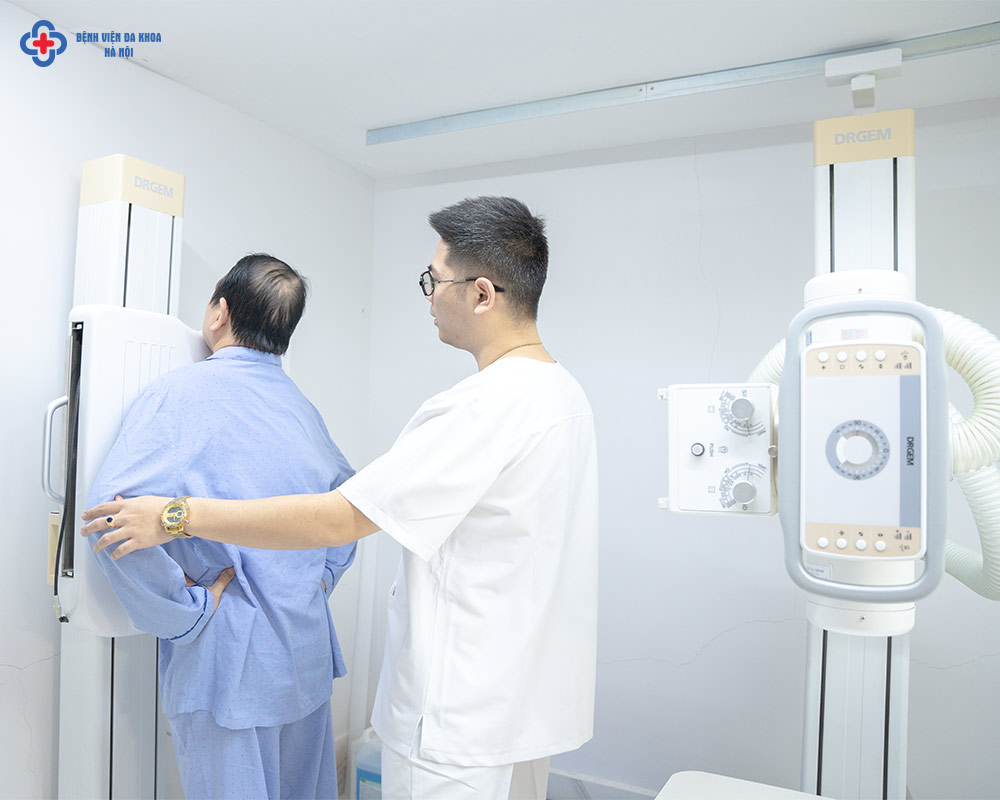 Chụp X-quang phổi để tầm soát ung thư phổi