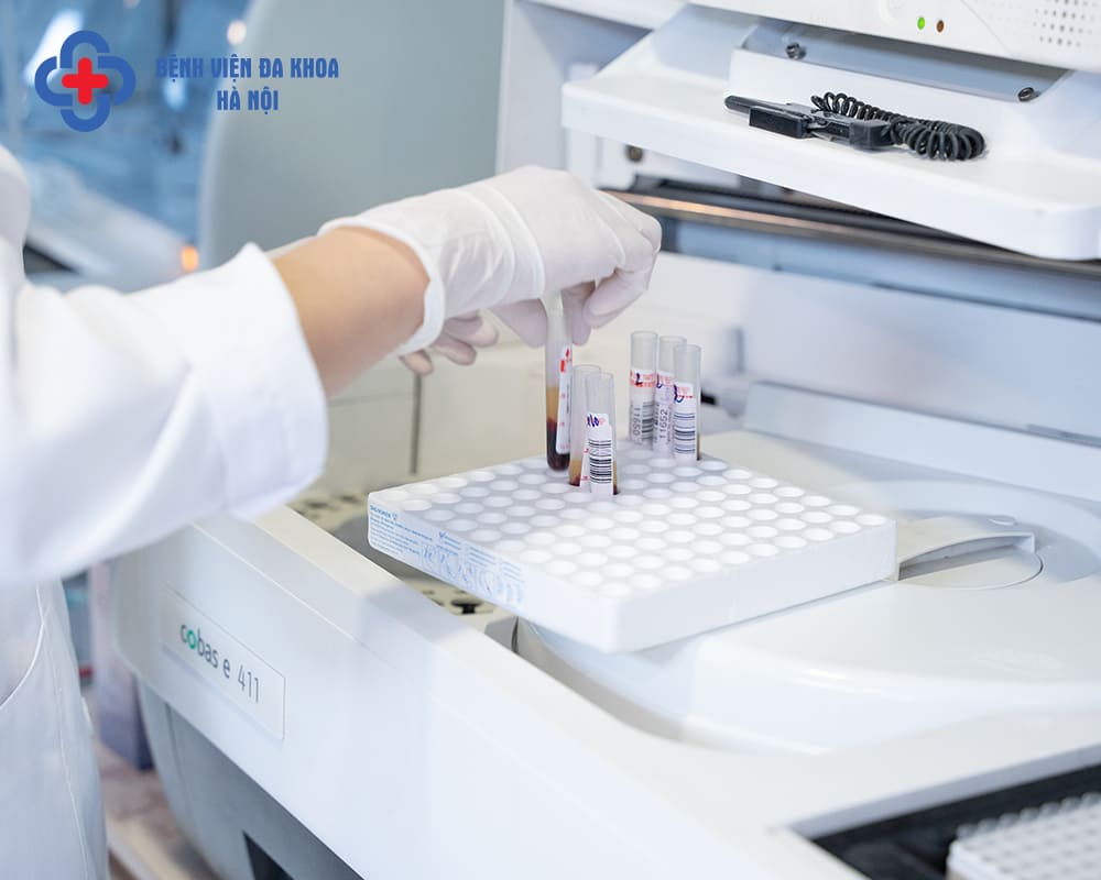 Xét nghiệm CA 19-9 giúp phát hiện dấu ấn ung thư đường tiêu hóa