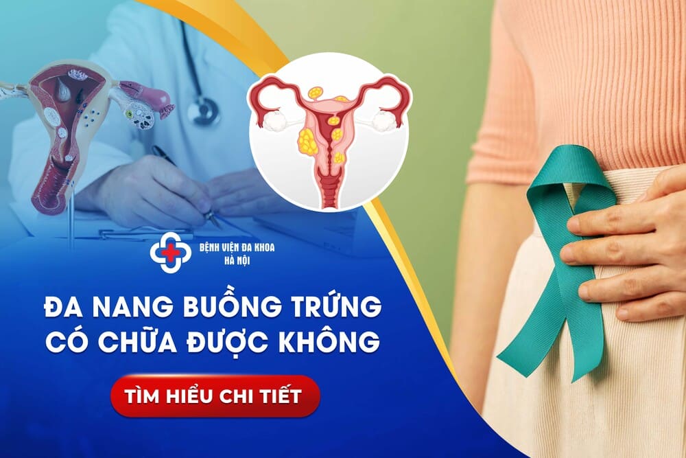 Đa Nang Buồng Trứng: Nguyên Nhân, Dấu Hiệu và Cách Điều Trị