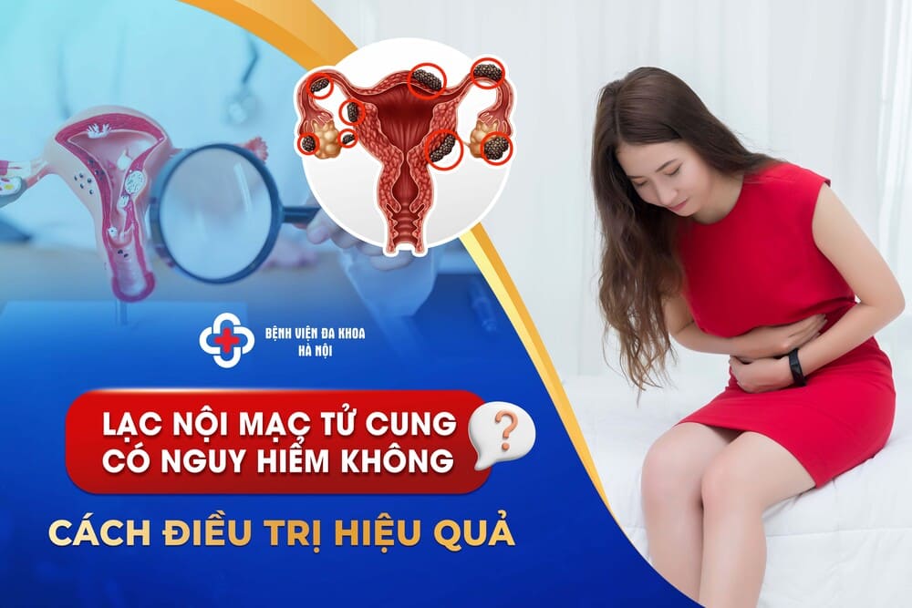 Lạc Nội Mạc Tử Cung Có Nguy Hiểm Không? Cách Điều Trị Hiệu Quả