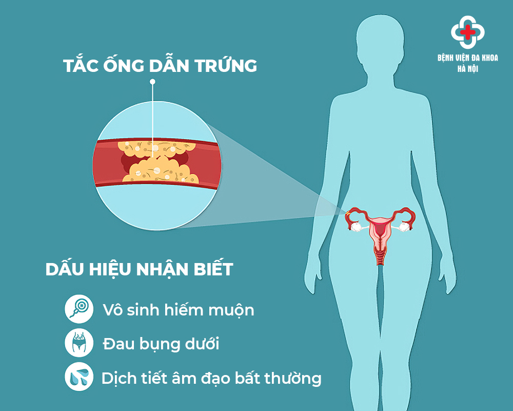 Dấu hiệu tắc vòi trứng dễ nhận biết