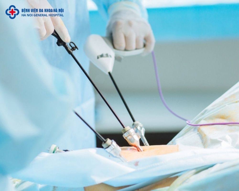 Các phương pháp chữa tắc vòi trứng bằng y học hiện đại