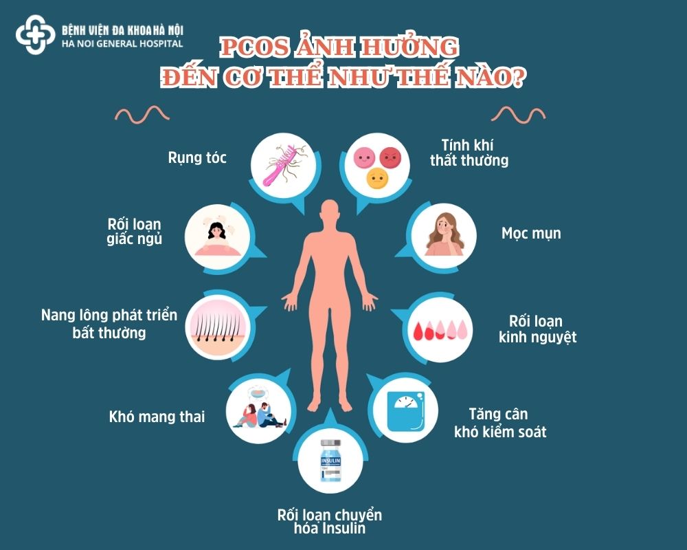 Nhiều nang buồng trứng ảnh hưởng đến cơ thể như thế nào?