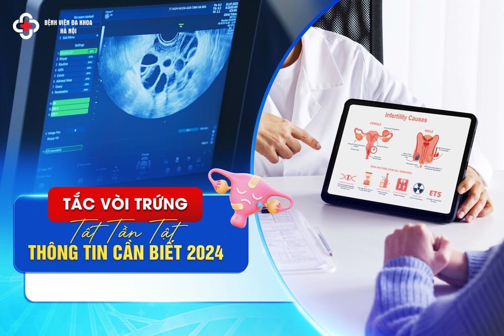 Tắc Vòi Trứng: Tất Tần Tật Thông Tin Cần Biết 2024