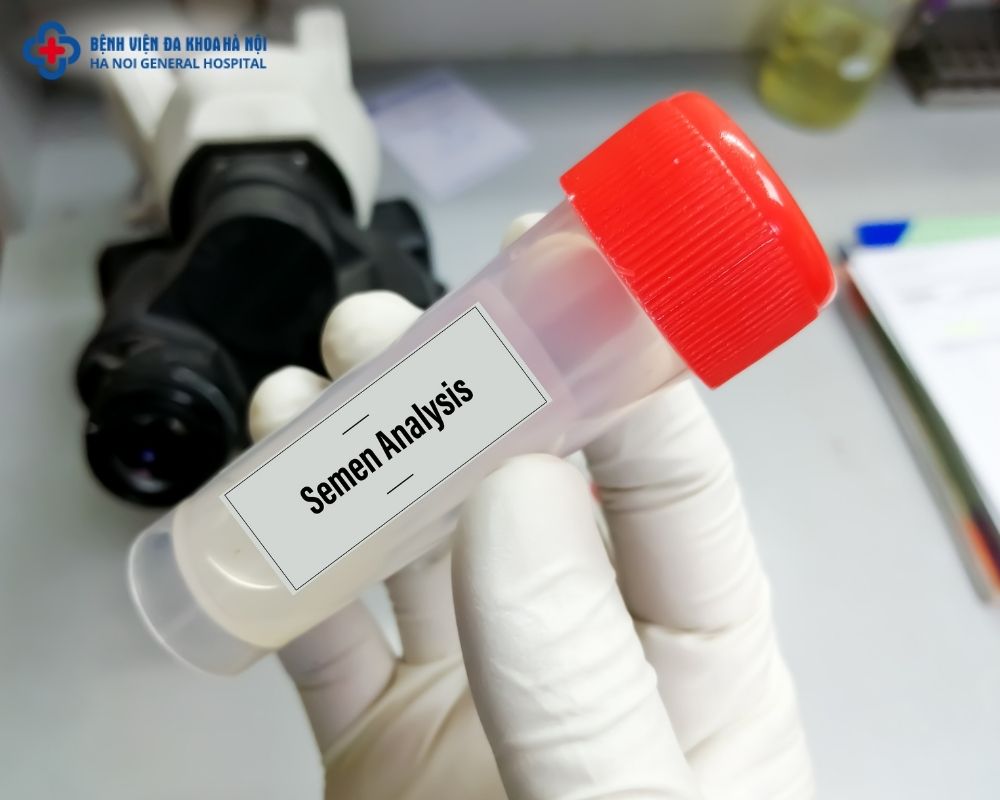 Xét nghiệm tinh dịch đồ