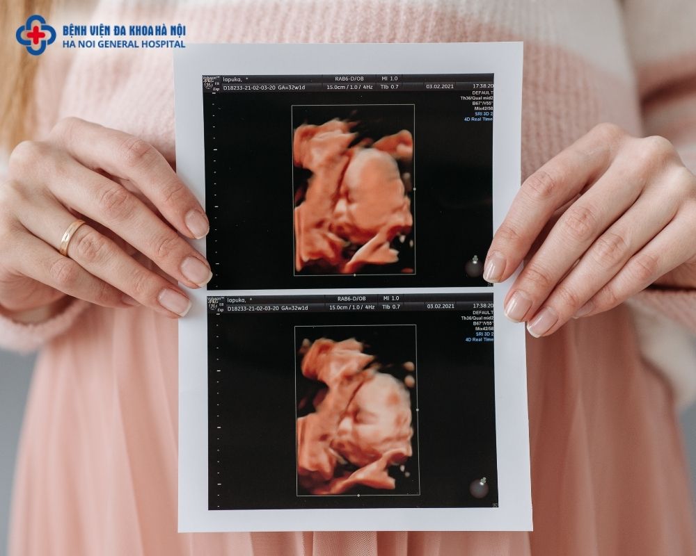 Ngày dự sinh này chỉ mang tính chất ước tính. Thai nhi có thể chào đời sớm hoặc muộn hơn ngày dự sinh từ 1-2 tuần