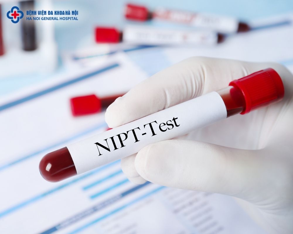 xét nghiệm NIPT sàng lọc đầy đủ cả bộ là 23 cặp nhiễm sắc thể