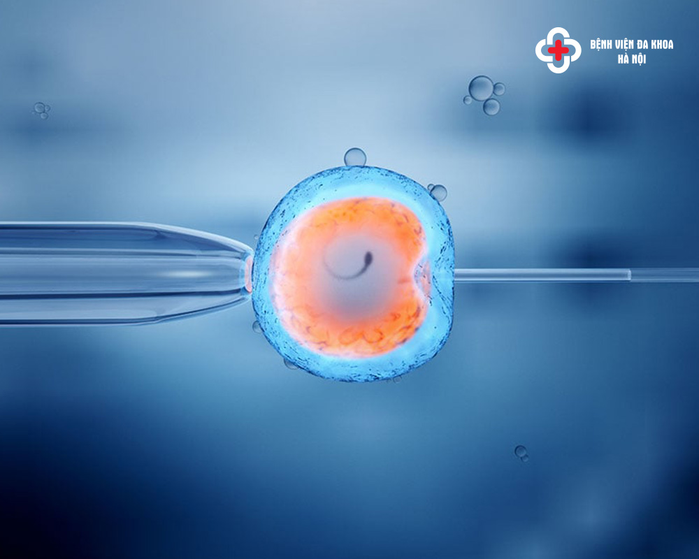 IVF - Phương pháp điều trị hiếm muộn hiện đại nhất hiện nay