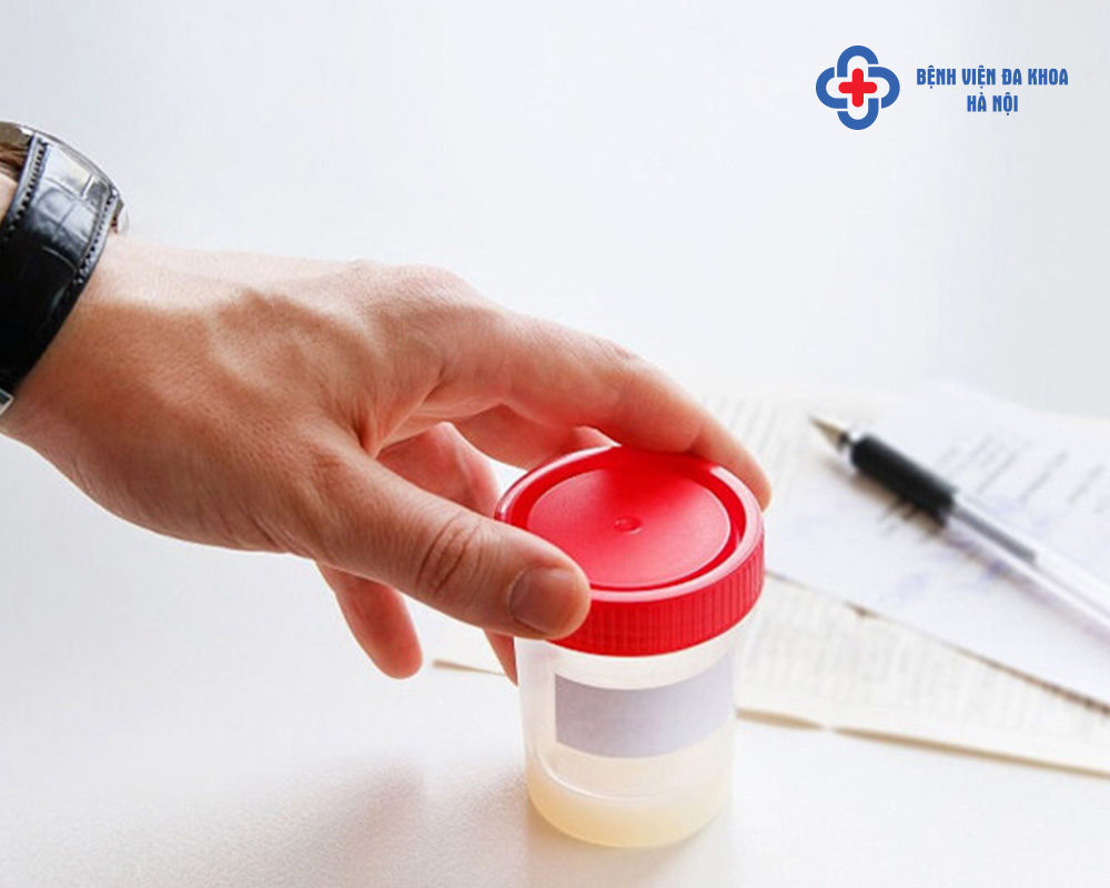 Đừng chủ quan với tình trạng tinh trùng bị vón cục