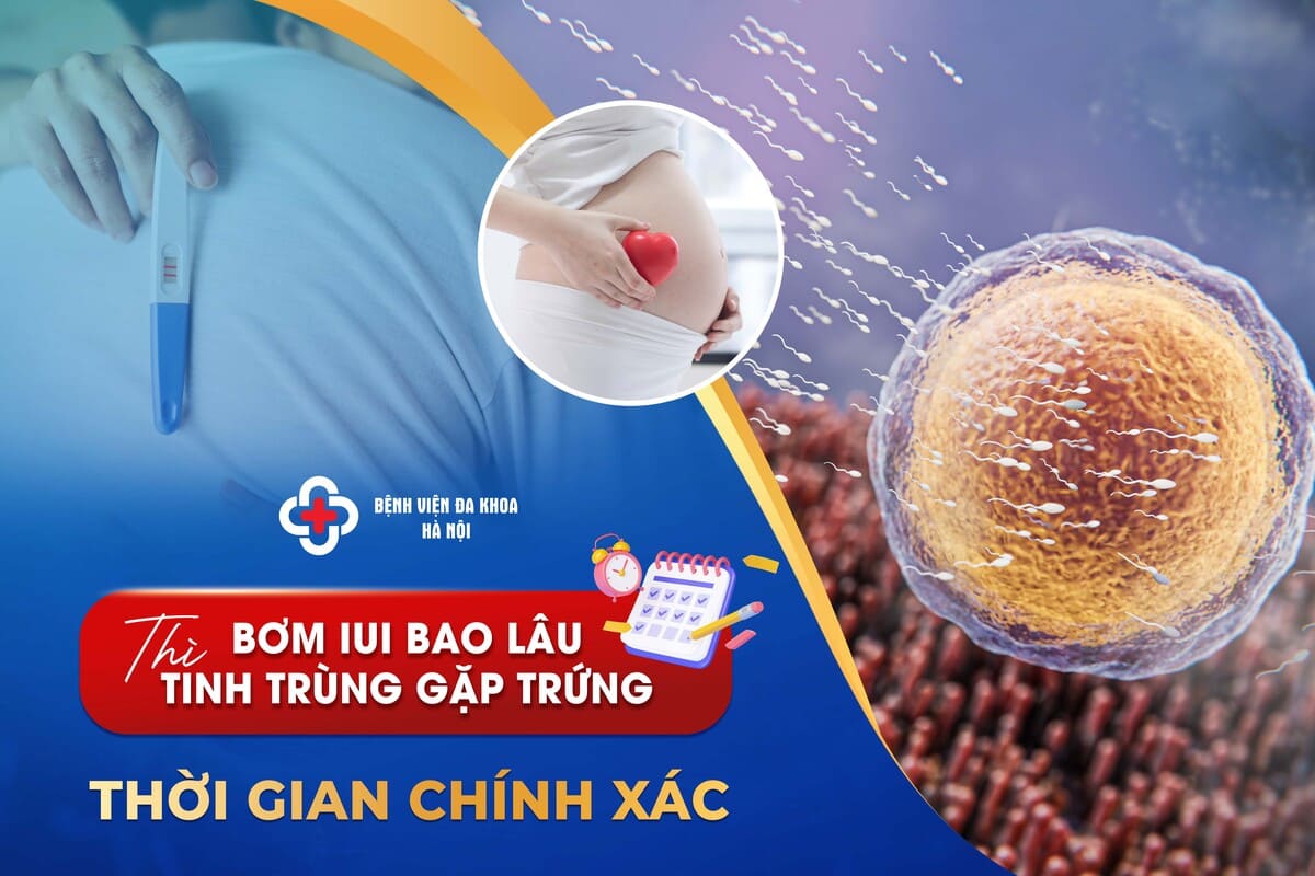 Bơm IUI Bao Lâu Thì Tinh Trùng Gặp Trứng? Thời Gian Chính Xác