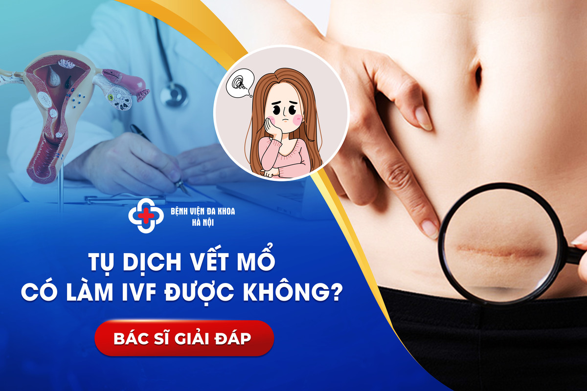 Tụ Dịch Vết Mổ Có Làm IVF Được Không