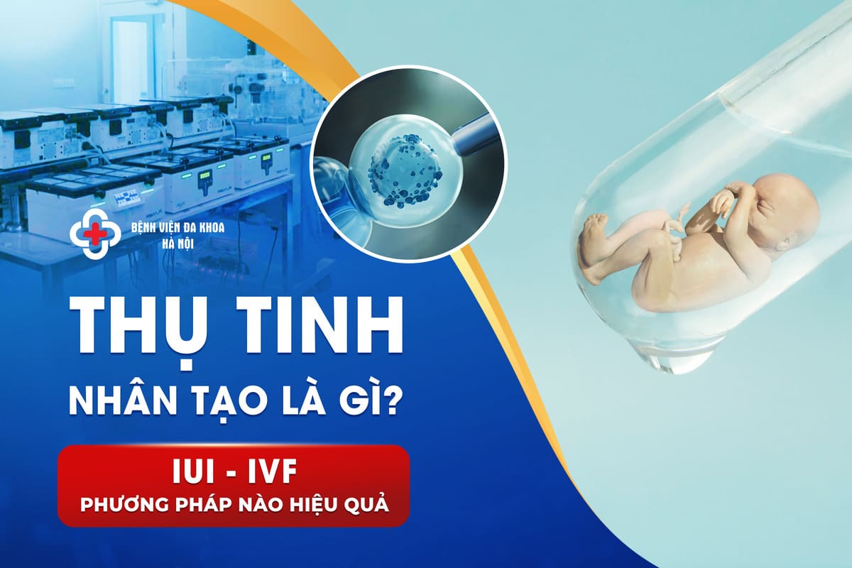 Thụ Tinh Nhân Tạo Là Gì? IUI, IVF: Phương Pháp Nào Hiệu Quả