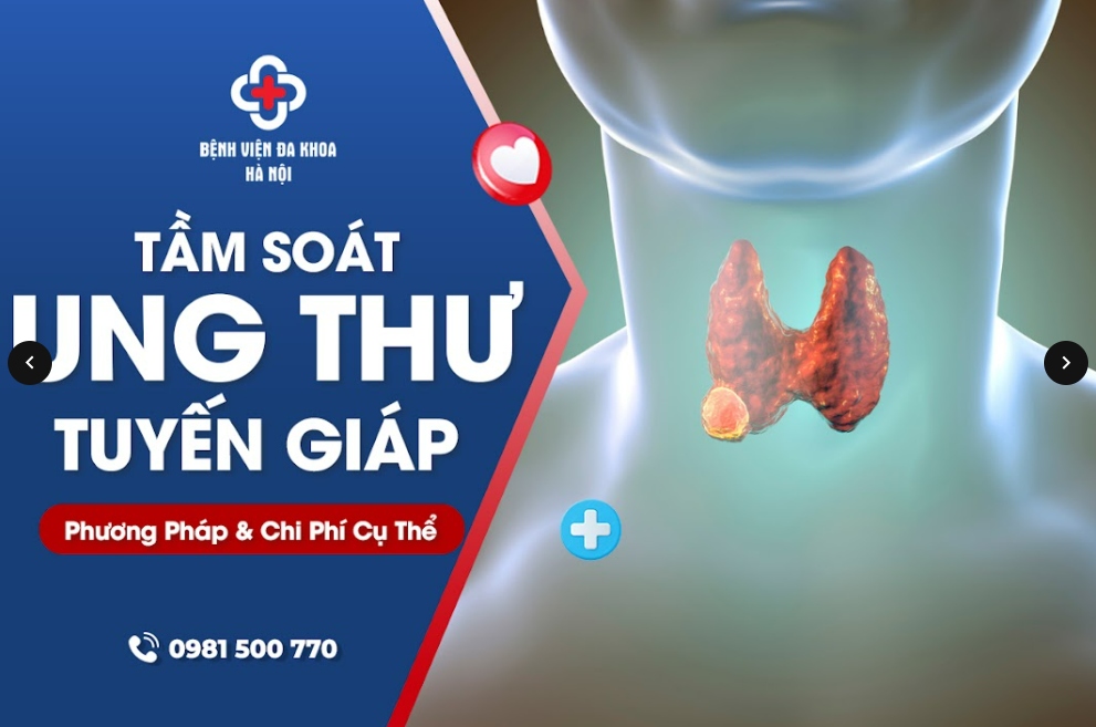 Tầm Soát Ung Thư Tuyến Giáp: Phương Pháp Và Chi Phí Cụ Thể