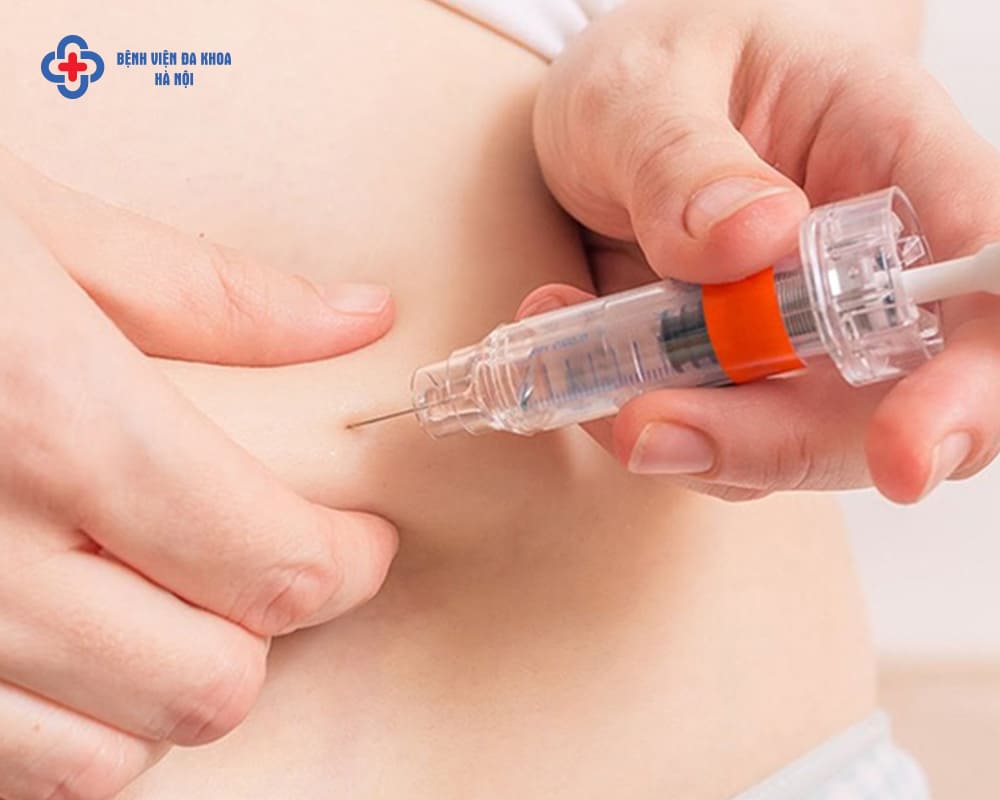 Hiểu về tiêm kích trứng để chủ động trên hành trình tìm con