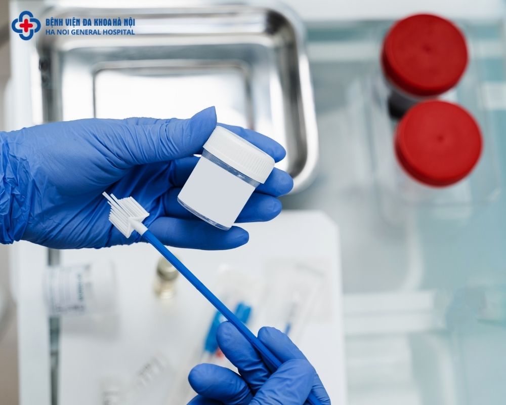 Xét nghiệm Pap smear