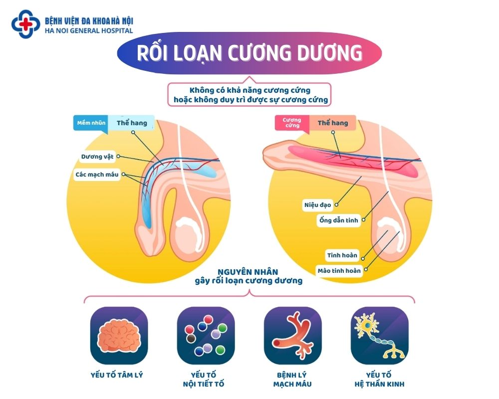 nguyên nhân rối loạn cương dương