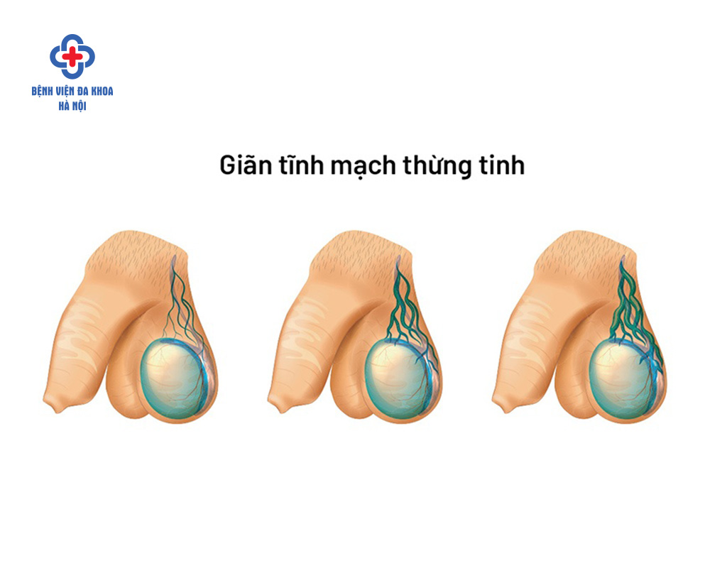 Có nhiều yếu tố tác động đến kết quả tinh dịch đồ