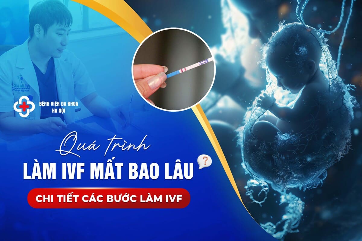 Quá trình làm IVF mất bao lâu? Chi tiết các bước làm IVF