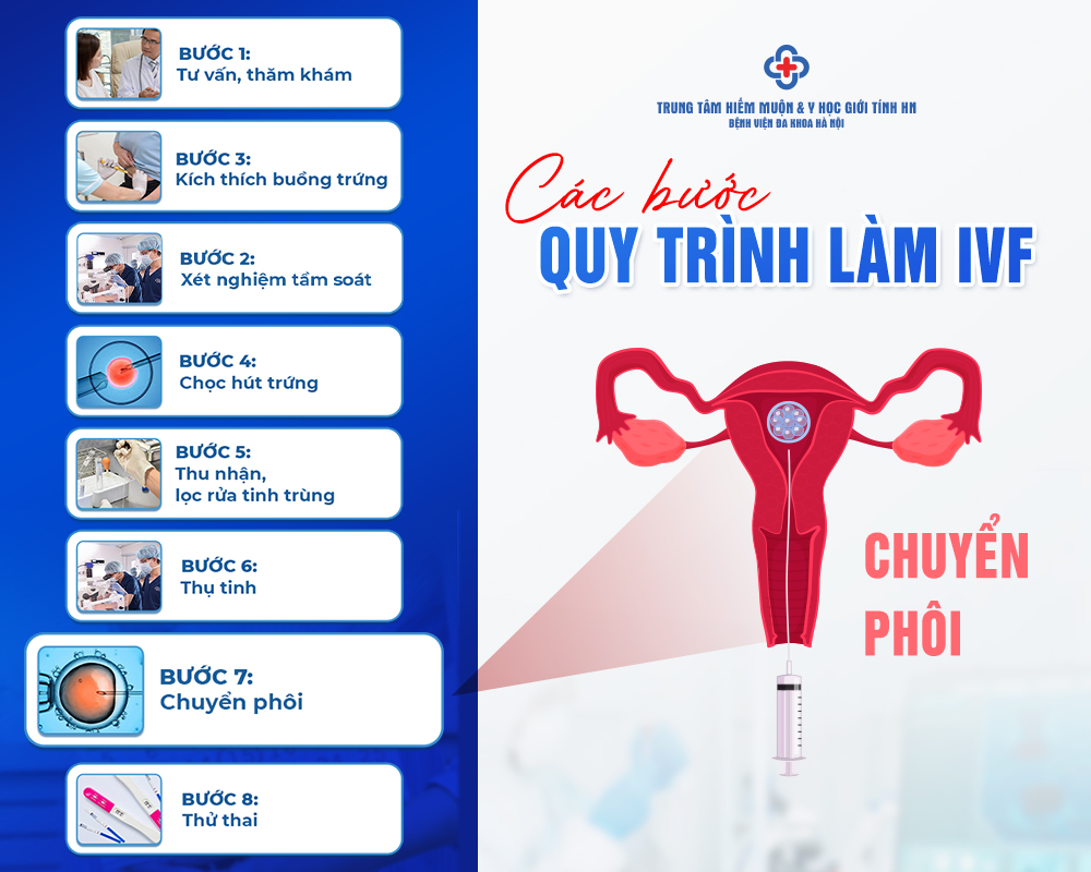 Quy trình thực hiện IVF