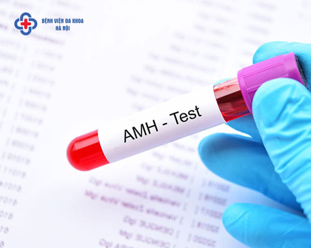 AMH là xét nghiệm quen thuộc trong các phương pháp hỗ trợ sinh sản