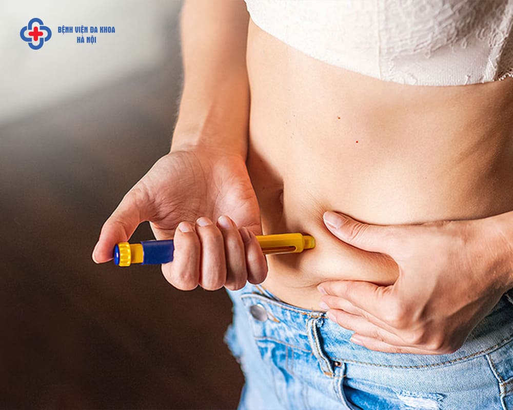 Tiêm kích trứng là một trong những bước bắt buộc trong hỗ trợ sinh sản